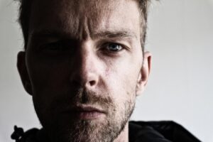 毛穴治療は美容皮膚科での痛みを伴う？その実態と対策を解説！