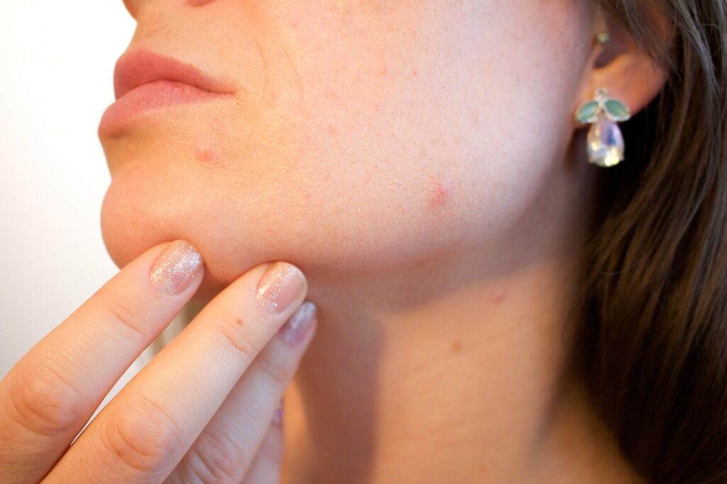 開き毛穴にレチノールは本当に効果があるの？